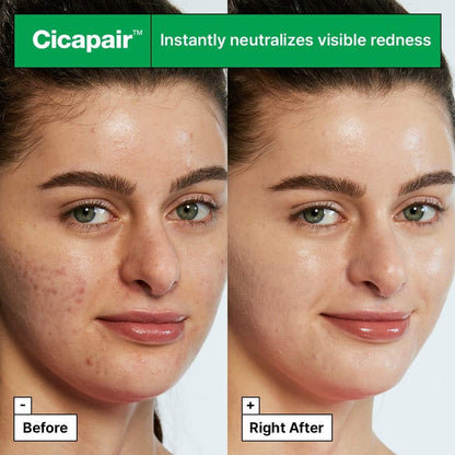 Cicapair™ Tiger Grass Color Correcting Treatment & Tiger Grass Camo Drops SPF 35